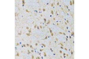 Immunohistochemistry of paraffin-embedded rat brain using ATG7 antibody. (ATG7 抗体  (AA 500-676))