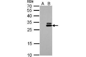 WB Image KLK7 antibody detects KLK7 protein by Western blot analysis. (Kallikrein 7 抗体)