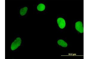 Immunofluorescence of purified MaxPab antibody to NOSIP on HeLa cell.