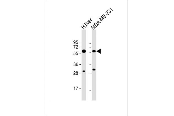UGT2B4 Antikörper  (N-Term)