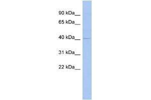 WB Suggested Anti-MSL3L1 Antibody Titration:  0. (MSL3 抗体  (Middle Region))