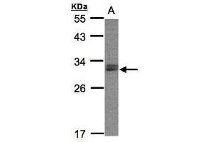 WB Image Sample(30 ug whole cell lysate) A:Raji , 12% SDS PAGE antibody diluted at 1:2000 (NSMCE1 抗体  (Center))