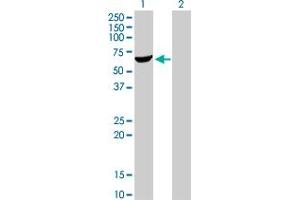 Western Blot analysis of AKT1 expression in transfected 293T cell line by AKT1 monoclonal antibody (M01), clone 4C3. (AKT1 抗体  (AA 381-480))
