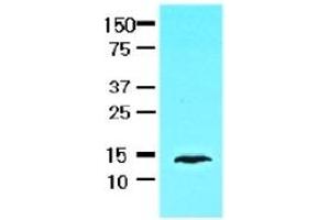 Western Blotting (WB) image for anti-Fatty Acid Binding Protein 1, Liver (FABP1) (AA 1-127), (N-Term) antibody (ABIN317518)