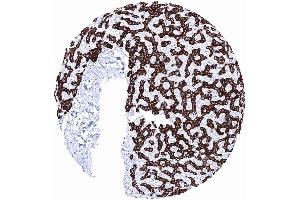 Strong Hepatocyte staining in hepatocytes while other structures of the liver remain negative (Hepatocyte Specific Antigen 抗体)
