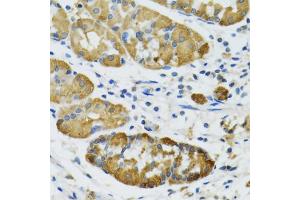 Immunohistochemistry of paraffin-embedded human stomach using PLA2G2D antibody (ABIN5974036) at dilution of 1/100 (40x lens). (PLA2G2D 抗体)