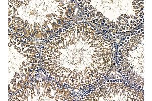 ABIN6257042 and ABIN6275505 at 1/100 staining rat testis tissue by IHC-P.