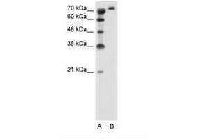 SLC6A18 anticorps  (AA 351-400)