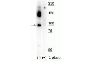 Western blot of human T47D cell lysate showing specific immunolabeling of the ~100 kDa CtIP phosphorylated at Ser326 in the first lane (-). (Retinoblastoma Binding Protein 8 抗体  (pSer326))