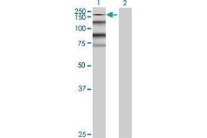 Lane 1: KIAA0460 transfected lysate ( 156. (KIAA0460 293T Cell Transient Overexpression Lysate(Denatured))