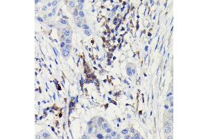 Immunohistochemistry (IHC) image for anti-Nitric Oxide Synthase 2, Inducible (NOS2) (AA 500-730) antibody (ABIN6144727)