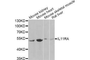 Western blot analysis of extracts of various cell lines, using IL11RA Antibody (ABIN2563389) at 1:1000 dilution. (IL11RA 抗体)