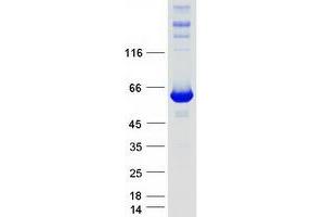 Validation with Western Blot