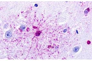 Image no. 1 for anti-G Protein-Coupled Receptor 84 (GPR84) (Transmembrane Domain) antibody (ABIN1048885) (GPR84 抗体  (Transmembrane Domain))
