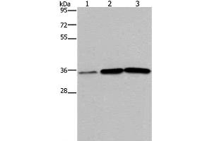 Western Blot analysis of Human testis tissue, A549 and PC3 cell using MAGEA3 Polyclonal Antibody at dilution of 1:400 (MAGEA3 抗体)