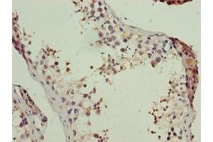 Immunohistochemistry of paraffin-embedded human testis tissue using ABIN7174200 at dilution of 1:100 (LSM7 抗体  (AA 2-103))