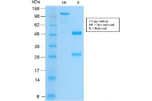 SDS-PAGE Analysis Purified CD61 Rabbit Recombinant Monoclonal Antibody (ITGB3/2166R). (Recombinant Integrin beta 3 抗体  (AA 385-490))