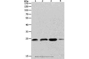 Western blot analysis of K562, 231 and Hela cell, Human fetal brain tissue, using RHOA Polyclonal Antibody at dilution of 1:400 (RHOA 抗体)