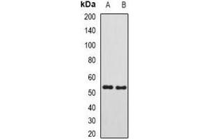 Western blot analysis of SUFU expression in mouse testis (A), rat kidney (B) whole cell lysates. (SUFUH 抗体)