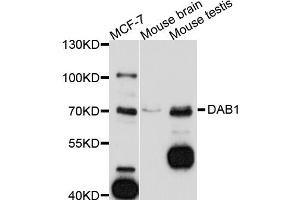 Western blot analysis of extracts of various cell lines, using DAB1 antibody (ABIN5997560) at 1/1000 dilution. (DAB1 抗体)