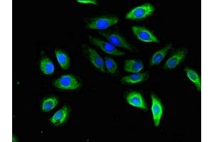 Immunofluorescent analysis of A549 cells using ABIN7170725 at dilution of 1:100 and Alexa Fluor 488-congugated AffiniPure Goat Anti-Rabbit IgG(H+L) (STMN2 抗体  (AA 61-129))