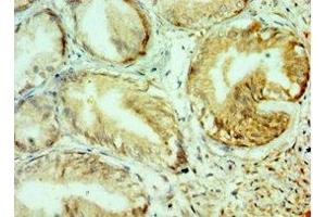 Immunohistochemistry of paraffin-embedded human prostate tissue using ABIN7148222 at dilution of 1:100 (COL1A1 抗体  (AA 521-680))