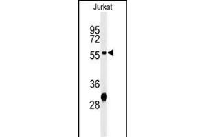 Western blot analysis of HADHB Antibody (C-term) (ABIN653816 and ABIN2843089) in Jurkat cell line lysates (35 μg/lane). (HADHB 抗体  (C-Term))
