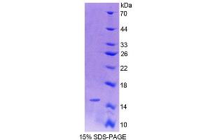 SDS-PAGE analysis of Rat OT Protein. (OXT 蛋白)
