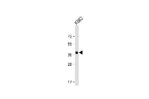 YOD1 抗体  (C-Term)