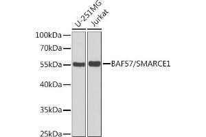 Western blot analysis of extracts of various cell lines, using B/B/SM antibody  at 1:1000 dilution.