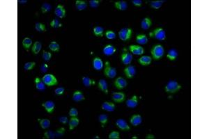 Immunofluorescence staining of Hela cells with ABIN7167342 at 1:166, counter-stained with DAPI. (RAB42 抗体  (AA 1-105))