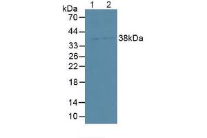 Figure. (SDCBP2 抗体  (AA 1-292))