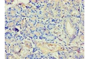 Immunohistochemistry of paraffin-embedded human pancreatic tissue using ABIN7144294 at dilution of 1:100 (Annexin VII 抗体  (AA 259-488))