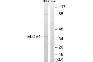 Western blot analysis of extracts from HeLa cells, using ELOVL4 antibody. (ELOVL4 抗体  (Internal Region))