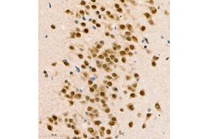 Immunohistochemistry of paraffin embedded mouse brain using COPS2 (ABIN7073324) at dilution of 1:1400 (400x lens) (CSN2 抗体)