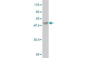 Western Blot detection against Immunogen (40. (BRD3 抗体  (AA 418-556))