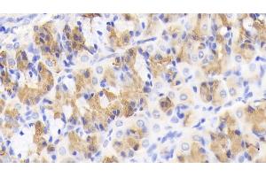 Detection of MCP1 in Porcine Stomach Tissue using Polyclonal Antibody to Monocyte Chemotactic Protein 1 (MCP1)