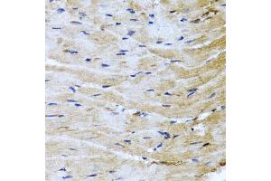 Immunohistochemistry of paraffin-embedded mouse heart using M6PR antibody (ABIN5975018) at dilution of 1/100 (40x lens). (M6PR 抗体)