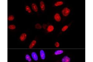 Confocal immunofluorescence analysis of U-2 OS cells using Ataxin 3 Polyclonal Antibody at dilution of 1:100. (Ataxin 3 抗体)