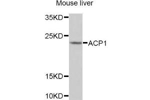 Western blot analysis of extracts of Mouse liver cells, using ACP1 antibody. (ACP1 抗体)