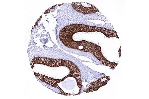 Immunohistochemistry (IHC) image for anti-Keratin 18 (KRT18) antibody (ABIN7477447)