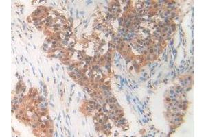 Figure. (PDXK 抗体  (AA 29-253))