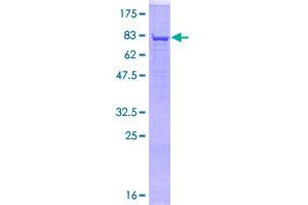 FUT8 Protein (AA 1-575) (GST tag)