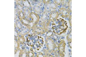 Immunohistochemistry of paraffin-embedded rat kidney using  Antibody (ABIN6127328, ABIN6136696, ABIN6136697 and ABIN6217467) at dilution of 1:100 (40x lens). (Adenylate Kinase 1 抗体  (AA 1-194))