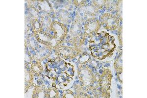 Immunohistochemistry of paraffin-embedded rat kidney using  Antibody (ABIN6127328, ABIN6136696, ABIN6136697 and ABIN6217467) at dilution of 1:100 (40x lens). (Adenylate Kinase 1 抗体  (AA 1-194))