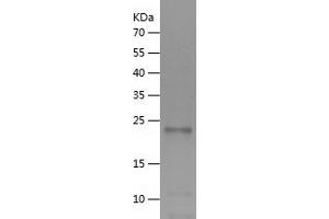 Western Blotting (WB) image for Interleukin 6 (IL6) (AA 23-210) protein (His tag) (ABIN7123607)