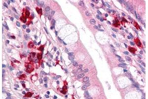 Anti-TFF2 antibody  ABIN1049400 IHC staining of human small intestine. (Trefoil Factor 2 抗体  (Internal Region))