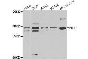 Western Blotting (WB) image for anti-Polymeric Immunoglobulin Receptor (PIGR) antibody (ABIN1877116) (PIGR 抗体)