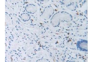 Immunohistochemistry (IHC) image for anti-Solute Carrier Family 12 (Sodium/Chloride Transporters), Member 3 (SLC12A3) (AA 3-146) antibody (ABIN7435784)