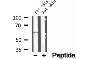 Western blot analysis of extracts of rat skin tissue, using P4HA1 antibody.